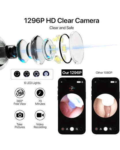 Earwax Removal Tool Kit with HD Camera Wifi Connection & 6 LED Lights Endoscope Tool Ear Cleaner for iOS & Android + 11 Silicone Tips Free (White)
